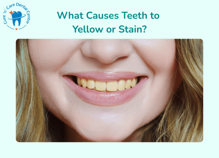teeth whitening