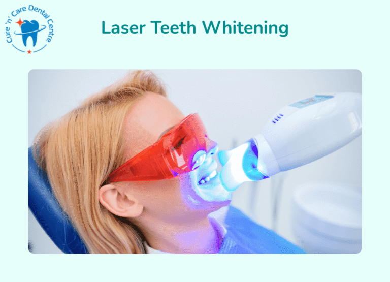 laser teeth whitening