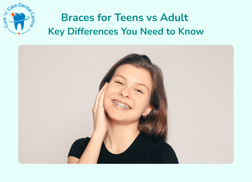 Braces for teens vs adult