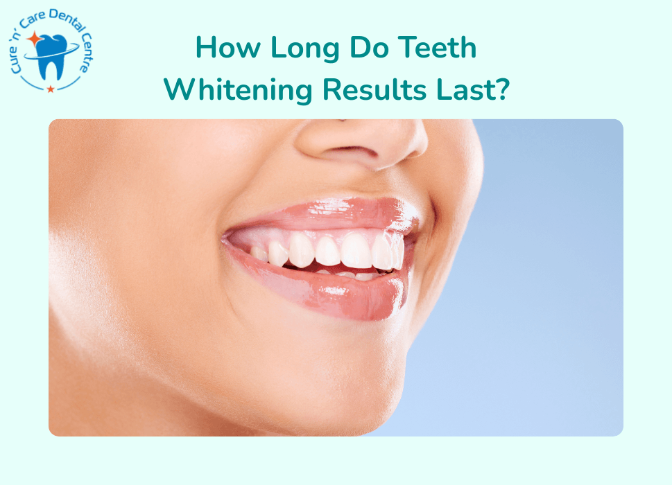 teeth whitening