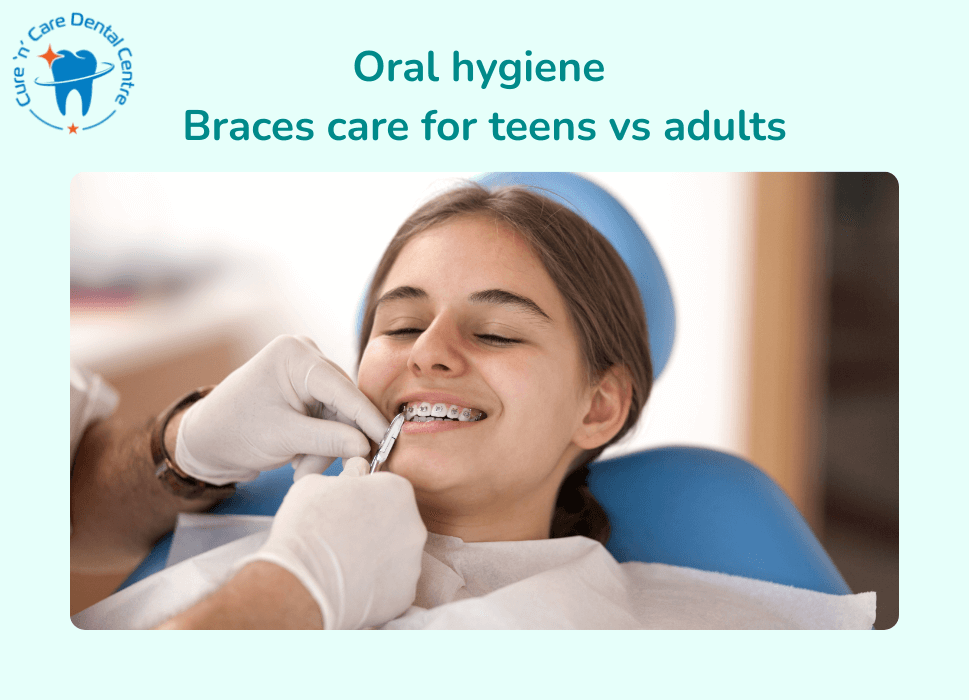Braces for teens vs adult