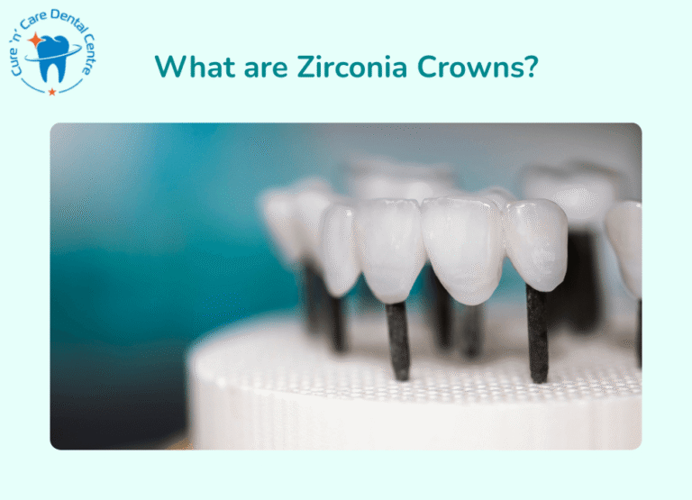 zirconia crowns