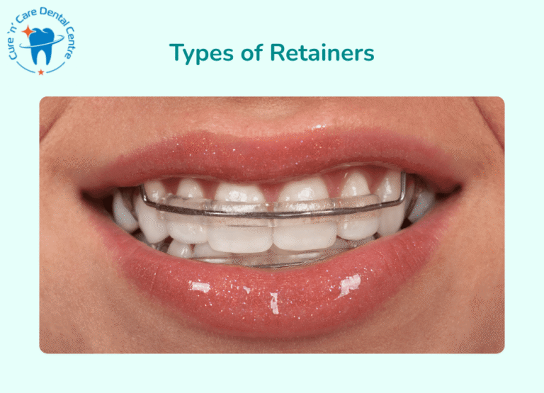 Teeth Retainers