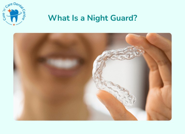 What Is a Night Guard