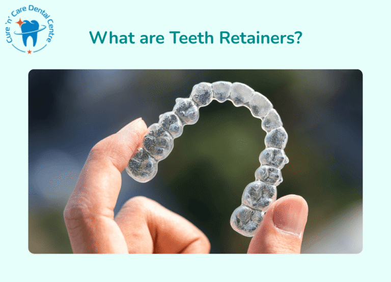 Teeth Retainers