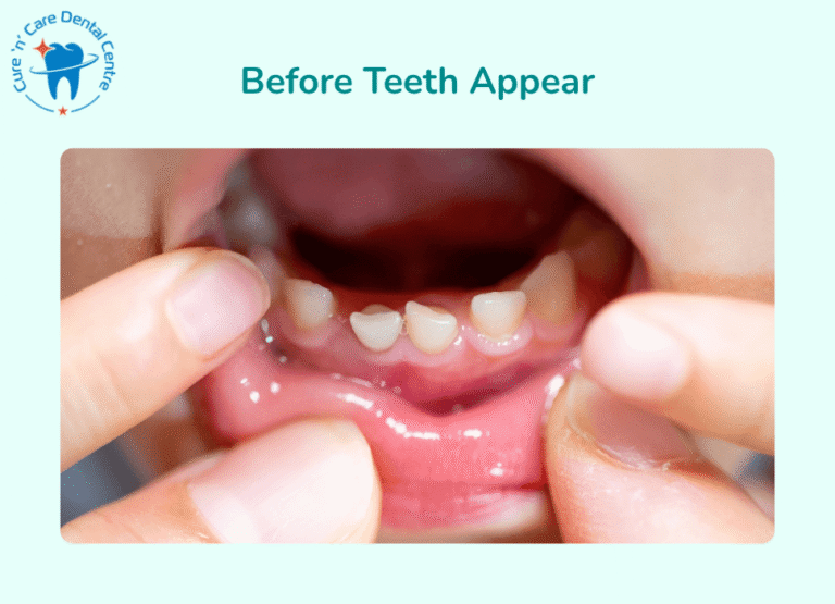 Before Teeth Appear of Baby