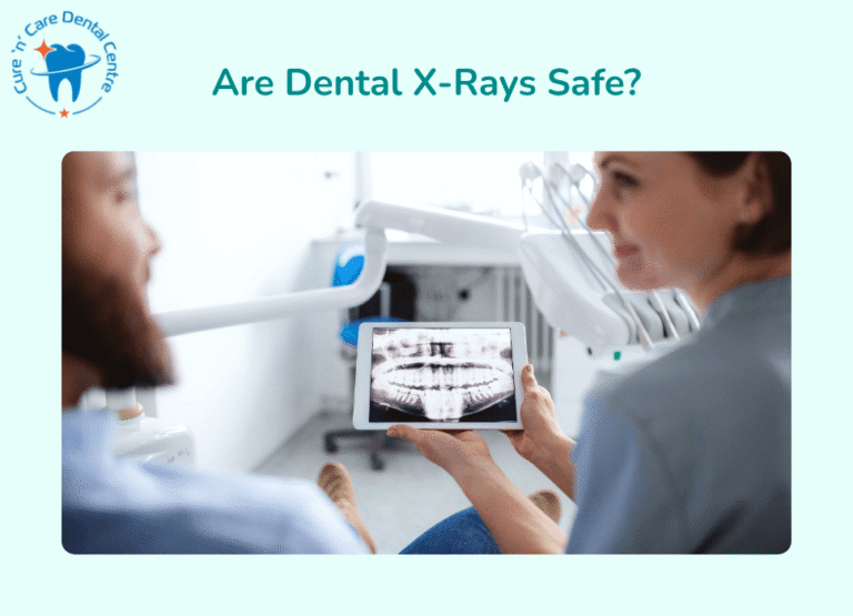 Dental X-Rays Safety