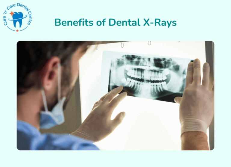 Benefits of Dental X-Rays Safety