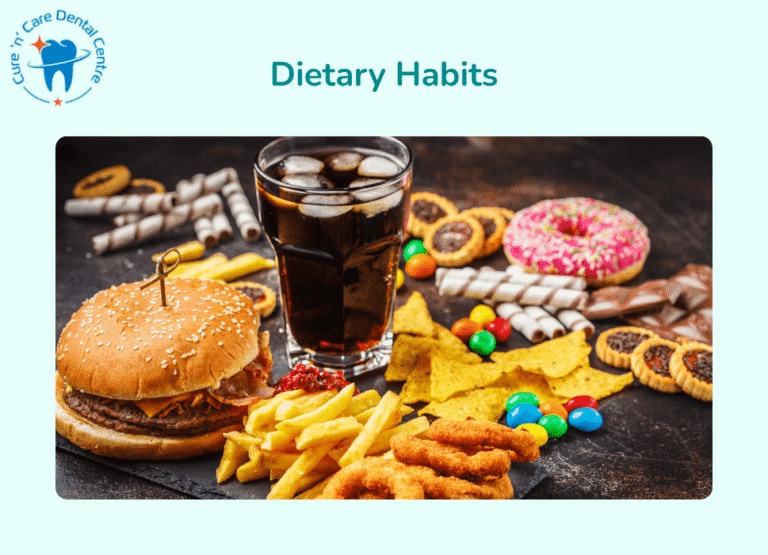 Dietary Habits of gum disease periodontics dentist