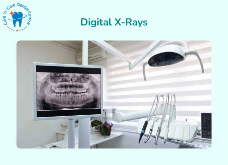 Digital X Rays