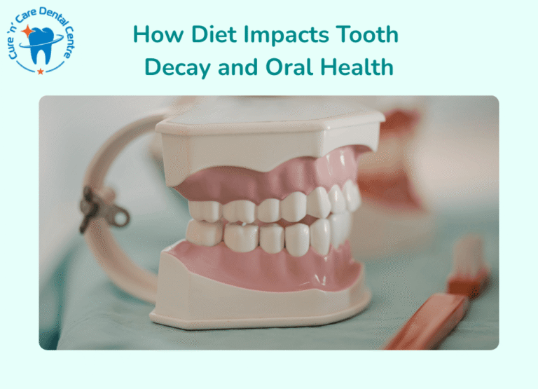 tooth decay treatment