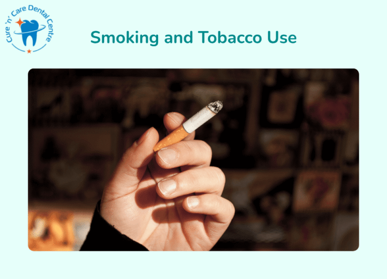 Smoking and Tobacco Use