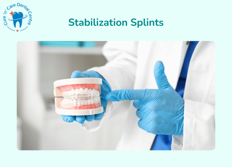 Stabilization Splints