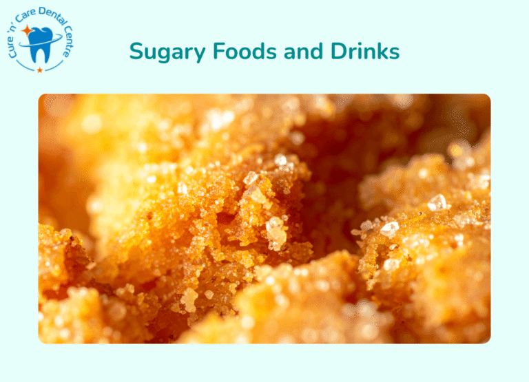 Sugary Foods and Drinks for tooth decay treatment