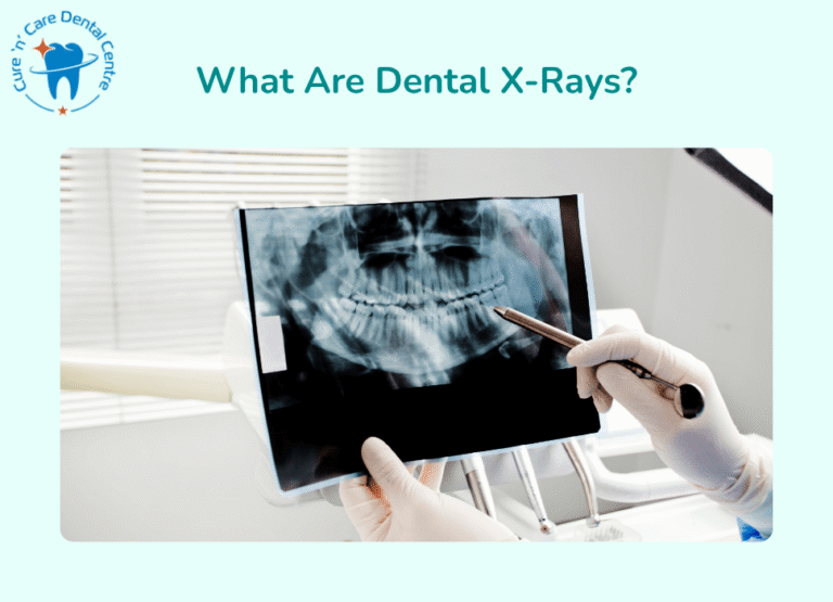 Dental X-Rays Safety